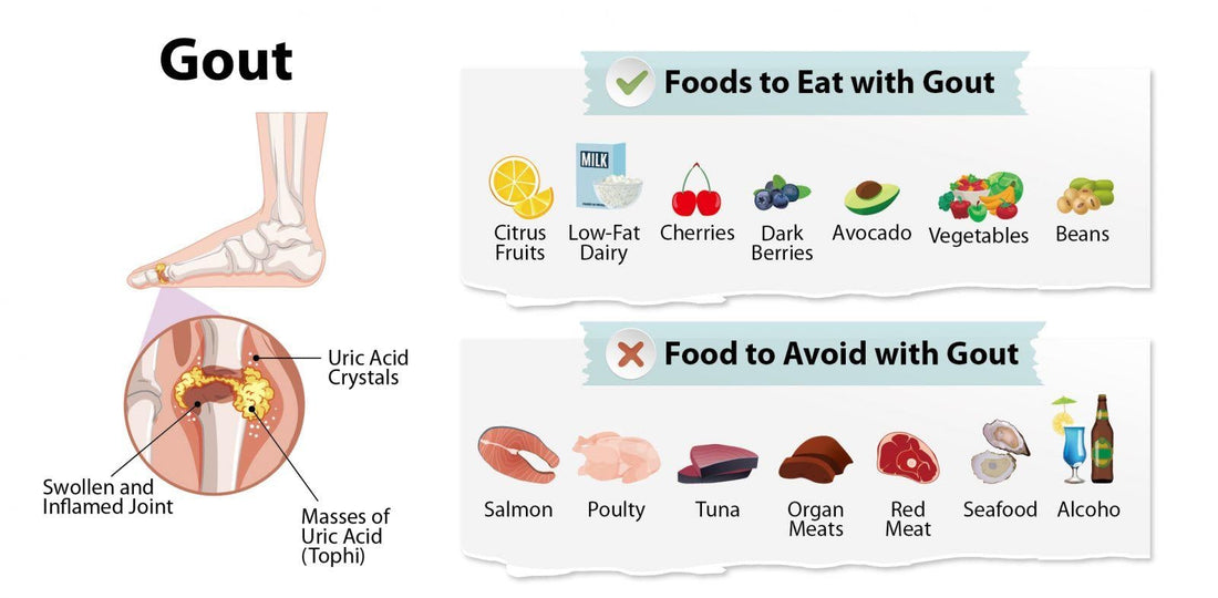 Gout Diet: Foods to Eat and Avoid for Uric Acid